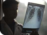 Pulmonary Medicine Treatment Services