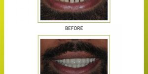 Cosmetic Dentistry