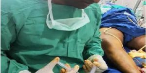 Varicose Vein Foam Sclerotherapy Services