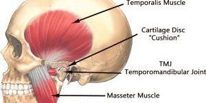 TMJ Disorder Treatment