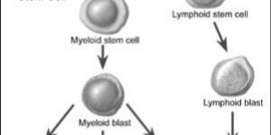 Acute Myeloid Leukemia Treatment (Adult)
