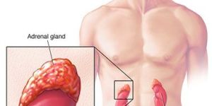 Adrenocortical Carcinoma Treatment (Adult)