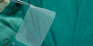 Surgical Mesh