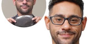 Hair Replacement Services