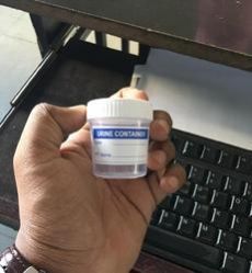 Urine 50 Ml Non Sterilized Container