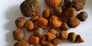 Gall Stones Ox
