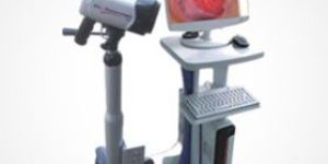 Digital Video Colposcope