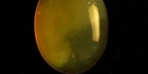 9.35 Carat Honey Opal Stone