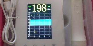 Portable Fetal Doppler