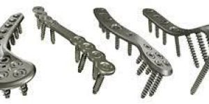 Orthopedic Plates