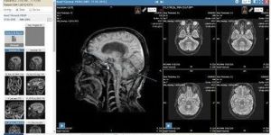Radiology PACS Software