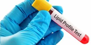 Lipid Profile Test