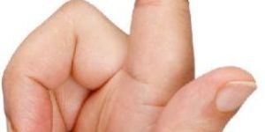 Mallet Finger Splint