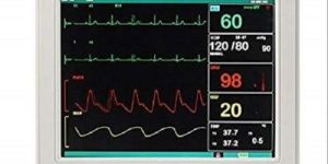 Patient Monitor