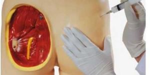 Intramuscular Injection Training Model