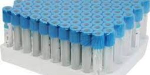 Sodium Citrate Blood Collection Tube