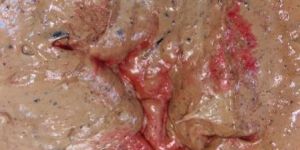 Liquid Pure Hing Tazaki