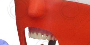 Endodontic Dental Phantom Head Manikin