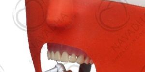 Restorative Dental Phantom Head Manikin