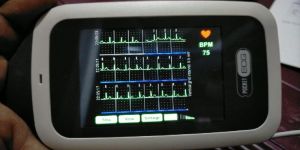 POCKECT ECG ELR MONITOR