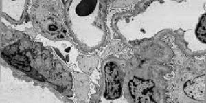 Nb21nC MAX Phase Powder