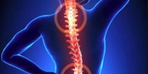 Other Brain and Spine Related Problems