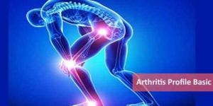 Arthritis Profile