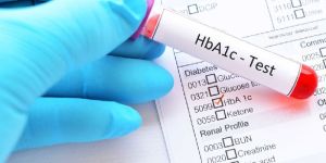 HbA1C Test