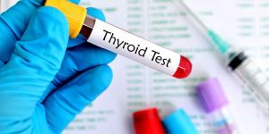 TSH Test