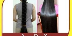 Hair Ayurvedic Treatment