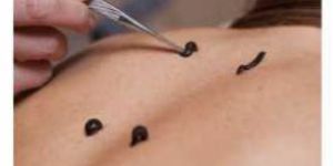 Raktamokshan Therapy Services