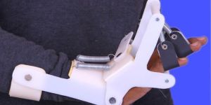 Radial Nerve Palsy Splint