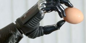Robotic Hand Prosthesis