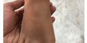 Artificial Silicone Foot