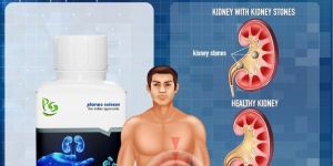 Kidney Stone Removal