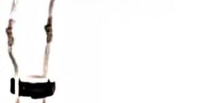 Knee Ankle Foot Orthosis