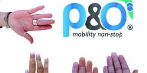 SILICONE FINGER PROSTHESIS