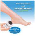 Callus Remover
