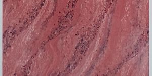 Aster Red Double Charged Vitrified Tiles