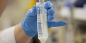 Milk Testing Services