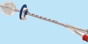 Suprapubic Catheter