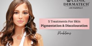 Skin Care Treatment Service in HSR Layout Bangalore