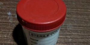 Plastic Sputum Container