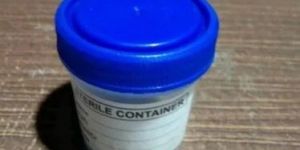 Urine Sample Container