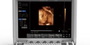 Color Doppler Ultrasound Machine