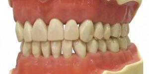 NAVADHA ZX Dental Typodont Jaw