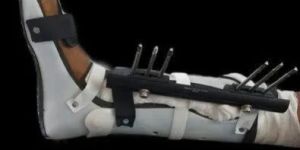 Thoracolumbosacral Orthosis Brace