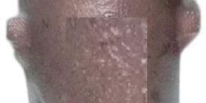 Hydraulic RAM Cylinder