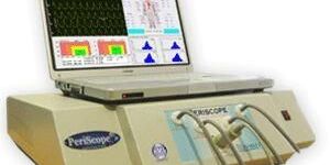 Peri Scope Analysis System