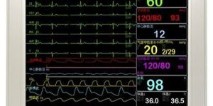 Patient Monitor